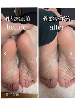一関整体院/施術ビフォーアフター（足）