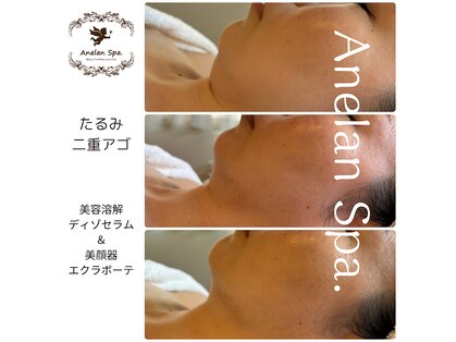 アネランスパ(Anelan Spa.)の写真