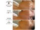 アネランスパ(Anelan Spa.)の写真