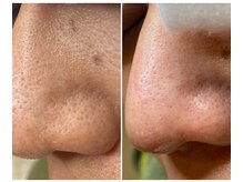 サイ(Sai)/before⇒after