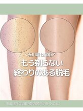 ララエピ/施術経験800名越え！結果重視☆