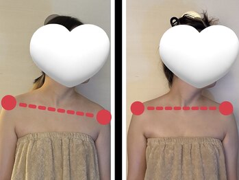 ビパール(bea pull)/ヘッドスパ　歪み改善