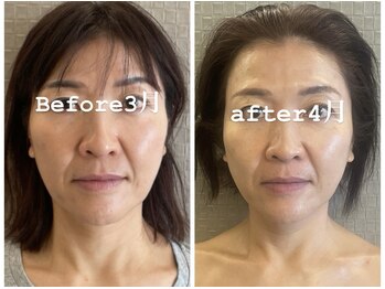 アリィ(Alii)/1ヶ月で別人レベルに