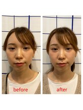 池袋ハート整体院/30代女性☆