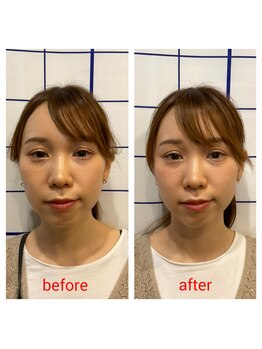 池袋ハート整体院/30代女性☆