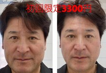 つるみ 小顔矯正 専門店