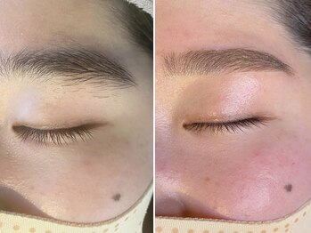 エープラス(A+)/眉パーマ+眉スタイリング