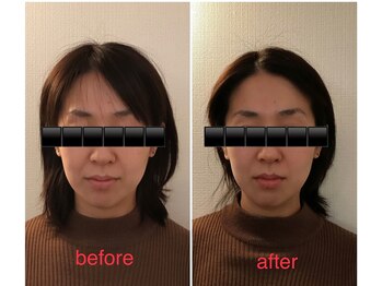 ココ(coco)/小顔リフトモニター募集中!