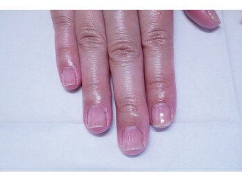 プチリリィ(Petit Lily)/注目の最強のネイルケアコース