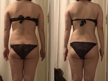 上野エステサロン レア(Lea)/痩身