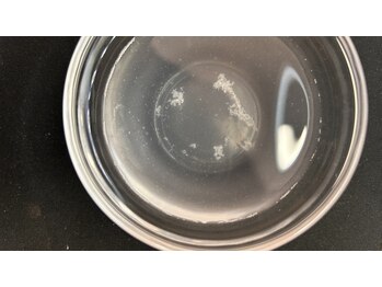 ミュー 岡崎店(mieux)/◇肌の角質・汚れがゴッソリ！