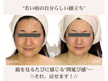 アンジェリカ(Angelica)