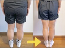 ポノフィット(PONO FIT.)/症例／ヒップ（下半身）