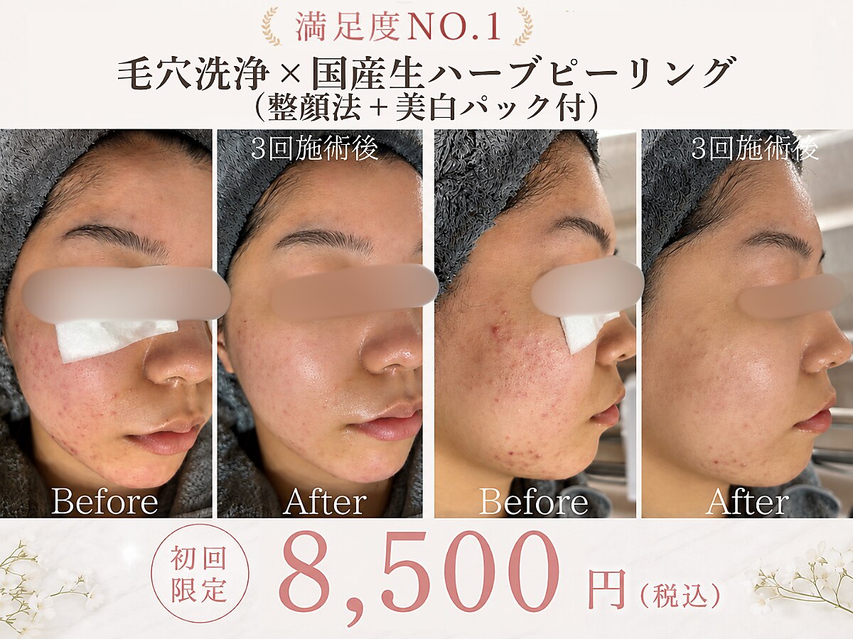 イーラボ 池袋店(e-LABO)｜ホットペッパービューティー