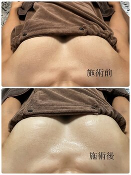 ルアナ(Luana)/BBLバストケア