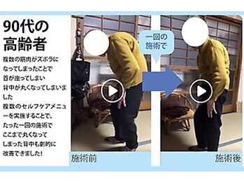 セルフケア整体 新宿店/実際のお客様◆1来店 腰痛/猫背