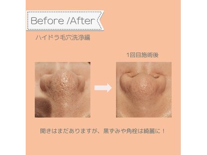 リーカモミール(Re.chamomile)の写真