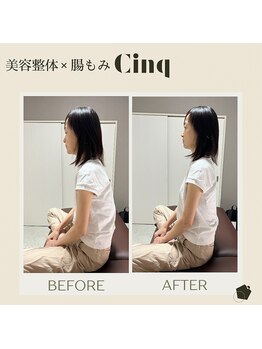 サンク(Cinq)/整体と矯正にて猫背/肩こり改善