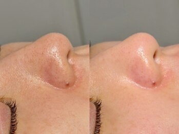 ルーナジェーナ(Luna llena)/池袋 エステ ルーナジェーナ