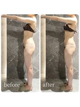 インディバ 六本木/【背中腰腹部上半身集中】痩身