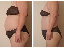 マナ(mana)/３か月１０キロで人生変わる◎