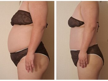 マナ(mana)/3か月10キロで人生変わる◎