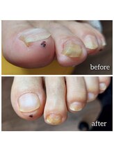 爪切り屋 足楽/