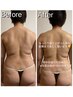 【背中のハミ肉、二の腕絞り！】背面集中コース【ブライダルにも◎】