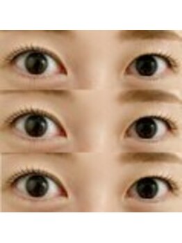 ララディーテ 北島店(LARAdite)/ラッシュリフト