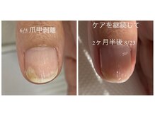 カラーホリック ネイルスパ(Colorholic Nailspa)/剥離ケア