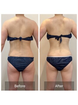 シューラディアント 金沢店(ShuRadiant)/見た目年齢-○才！背中美人