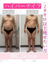 トータルサロンアイビーシー(トータルサロンIBC)/メンズエステハイパーナイフ痩身