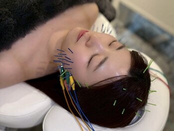 チョコバリ 渋谷店(chocobari)の写真/chocobariの美容鍼で肌の土台を底上げ！乾燥・くすみを一掃！内側から潤う理想の水光肌へと導きます