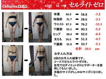 ラクワン(R coin)/