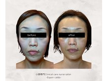 エスポワールカルド(Espoir caldo)/