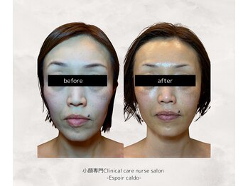 エスポワールカルド(Espoir caldo)/