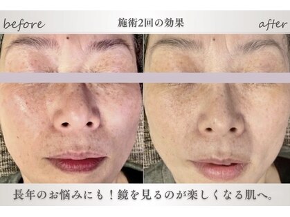 ミロワール(Miroire)の写真