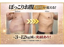 サロンドモモ(SALON de MOMO)