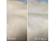 リアンジェ(Lianje)/背中Wax