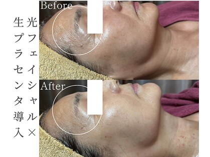 シストワ(sistoi)の写真
