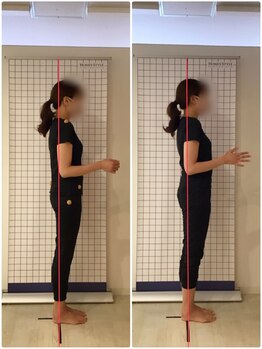 越谷KAJI整体院/産後骨盤矯正☆美姿勢ゲット☆