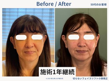 グロウズ(Glows)/継続が大切/1年前より美しく♪