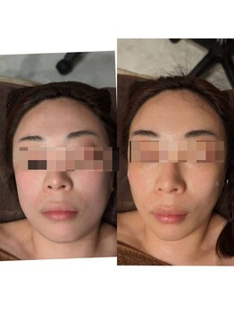 トリニティスペース(TrinitySpace)/レモンボトルビフォーアフター