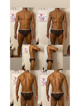 京橋メンズビューティーラボ(KMB LAB.)/ハイパーナイフのbefore/after