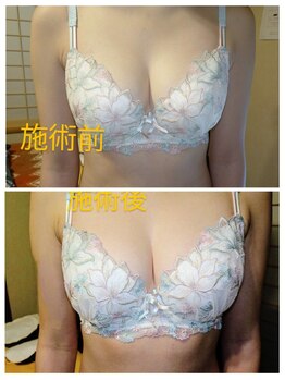 リラックスジュリー/アロマバストケア　２０００円