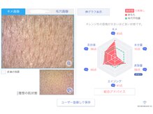 フレク(fleque)/あなたの肌状態、分析致します♪