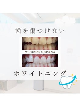 ホワイトニングショップ 葛西店/歯科提携 ホワイトニング専門店