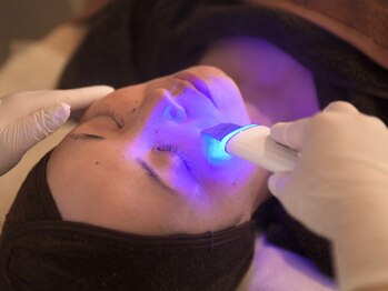 皇漢堂鍼灸療院/最新美容鍼【ダーマ鍼】の流れ-2