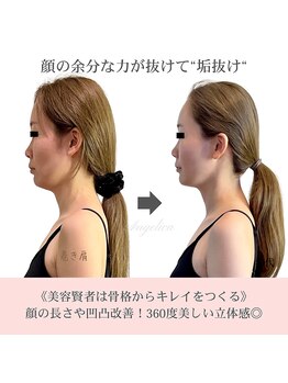 アンジェリカ(Angelica)/美容賢者は骨格からキレイを作る