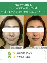 ブプラ 代々木上原店(BUPURA)/小顔×むくみ改善
